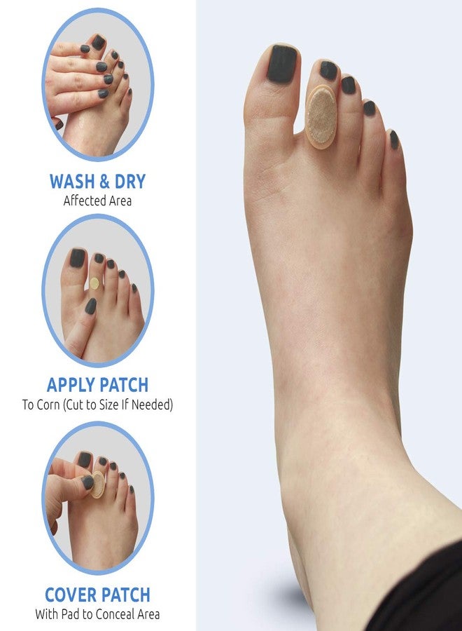 Comfort Zone Corn Removers Medicated Patches, Effective Corn Removal Pads with Salicylic Acid, 18 Medicated Patches and 18 Protective Pads - Image 5